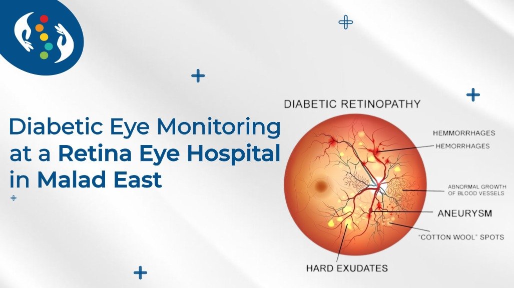Dry Eye Specialist in Mumbai — specialist eye care at Sentra Clinic & Hospital, Mumbai